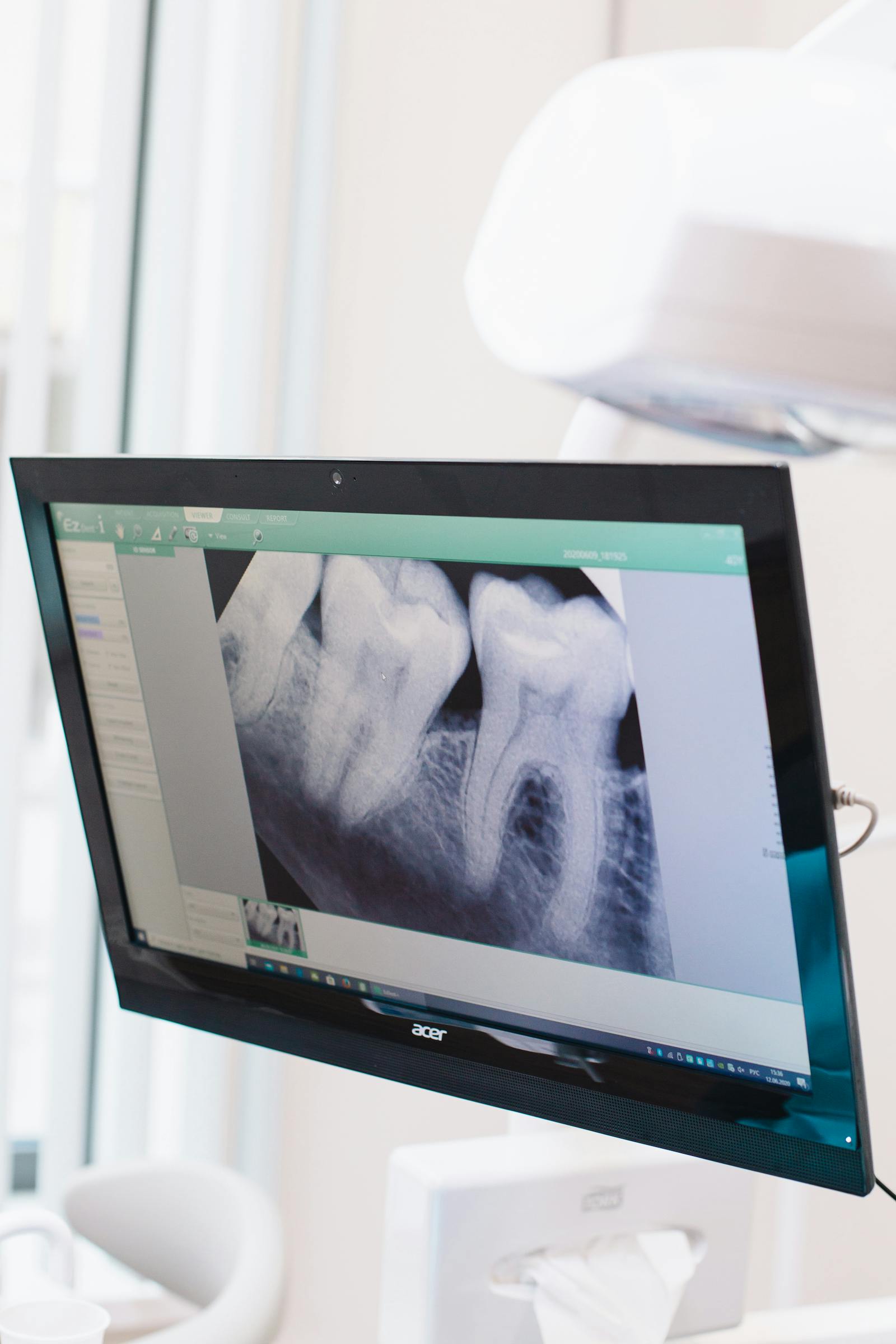Zahnradiologie — Maritima Dental & Esthetics