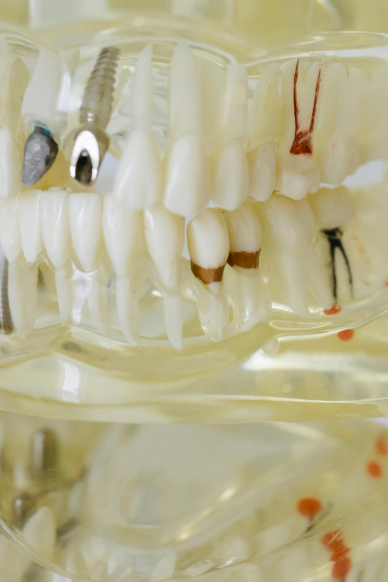 Zahnrestaurationen — Maritima Dental & Esthetics