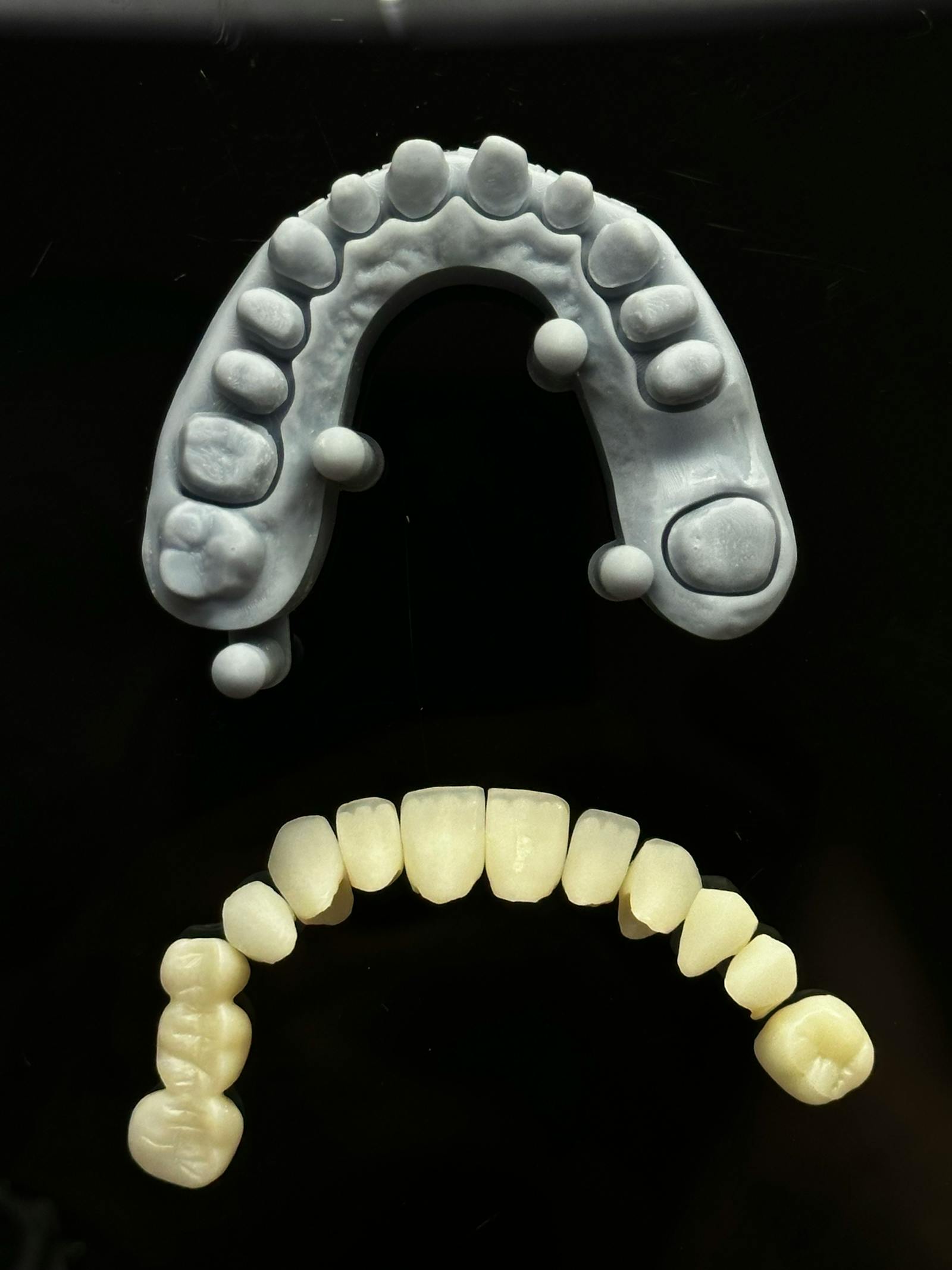 Prostodoncia — Maritima Dental & Esthetics Tenerife